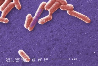 Cellules de E. coli